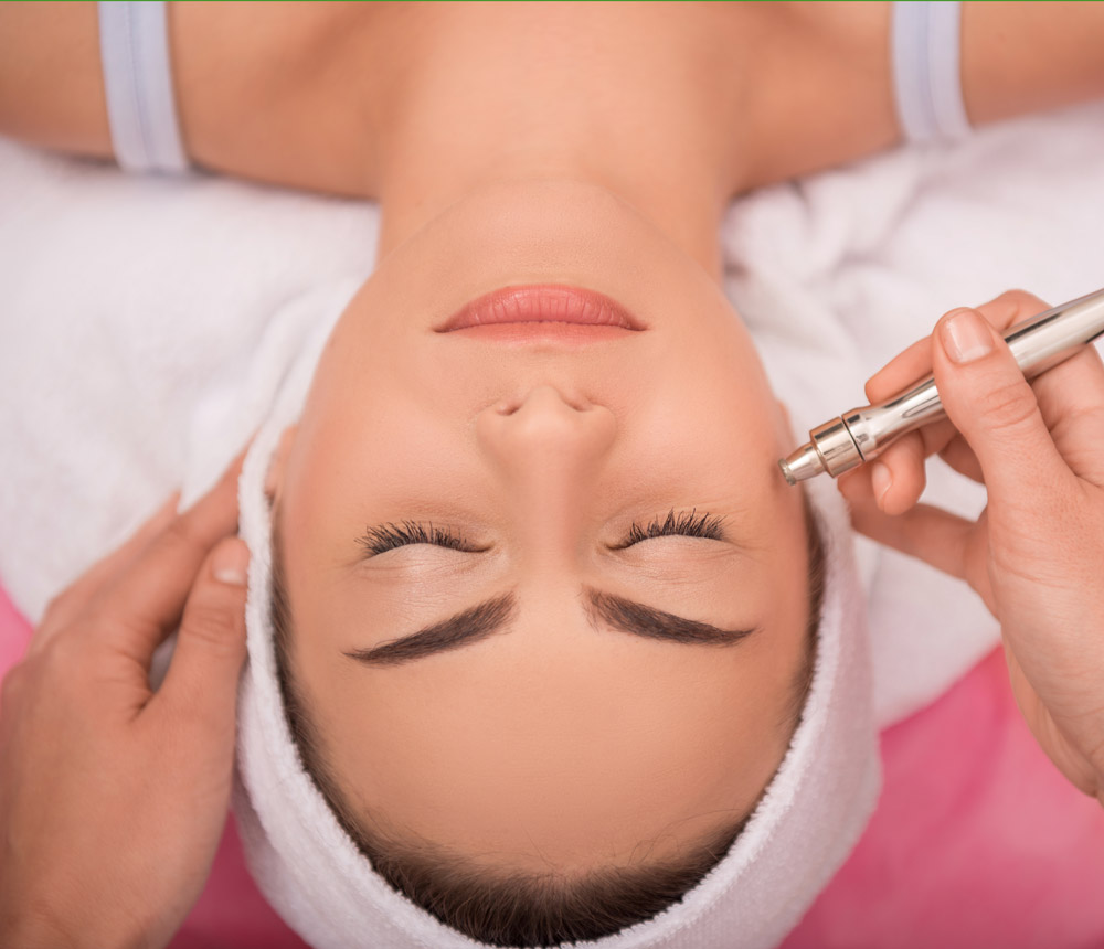 Microdermabrasion
