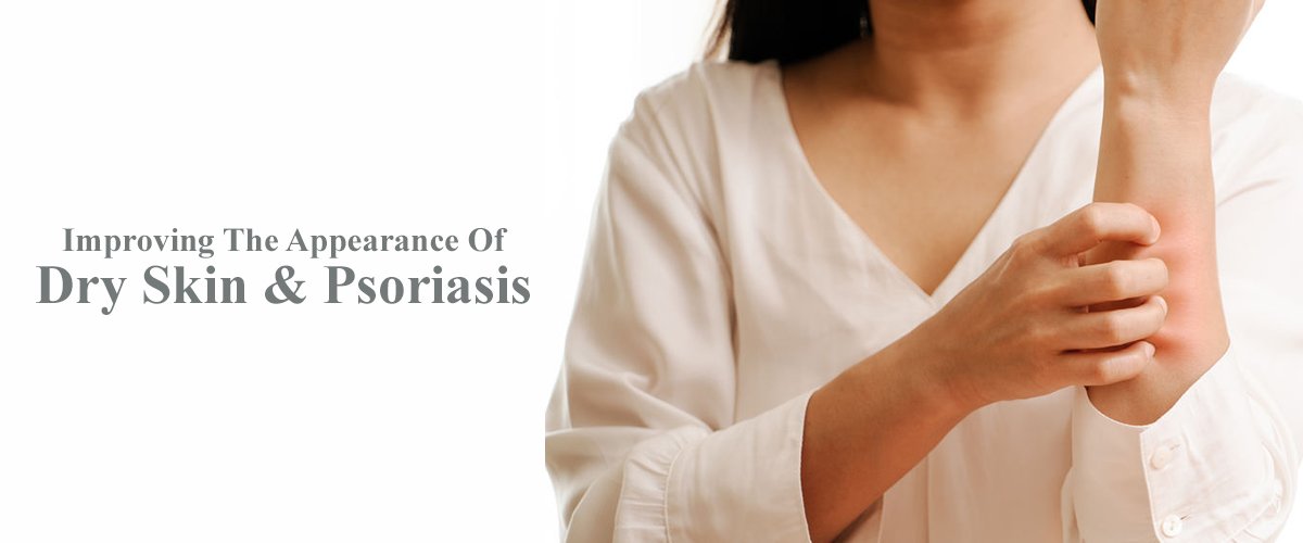Improving The Appearance Of Dry Skin Psoriasis banner