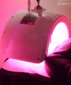 led light therapy for rosacea sufferers, Twickenham, Richmond