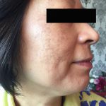 After Pigment