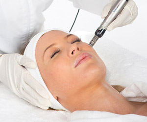 Dermapen Treatments Twickenham