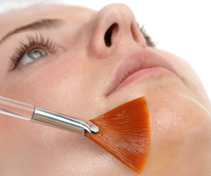 Skin Peels Improve The Appearance of Scarring at True Medispa in Twickenham