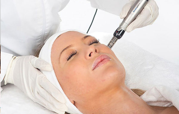 Does Dermapen Microneedling Hurt?