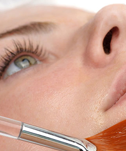 Skin Peel Twickenham