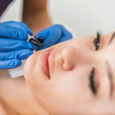 Electrolysis at Top Twickenham Spa Electrolysis at Top Twickenham Spa
