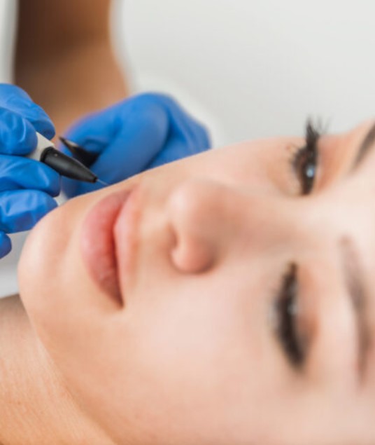 advanced electrolysis skin tag removal at True Medispa in Twickenham advanced electrolysis skin tag removal at True Medispa in Twickenham