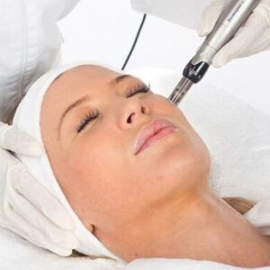 dermapen treatments at true medispa in twickenham