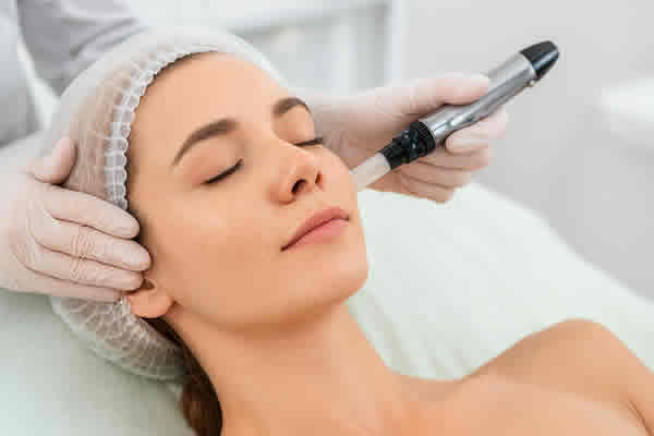Does Dermapen Microneedling Hurt? Here’s What Twickenham Clients Should Know