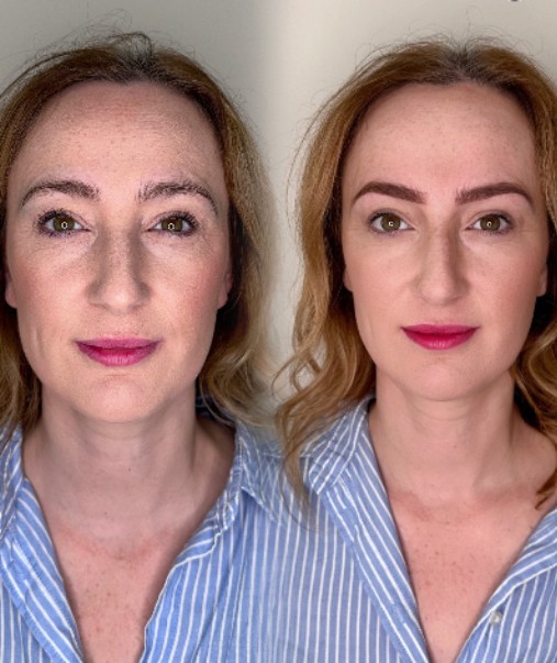 Twickenham’s Go-To Beauty Fixes: 4 Treatments for a Fresh, Flawless Look Twickenham’s Go-To Beauty Fixes: 4 Treatments for a Fresh, Flawless Look