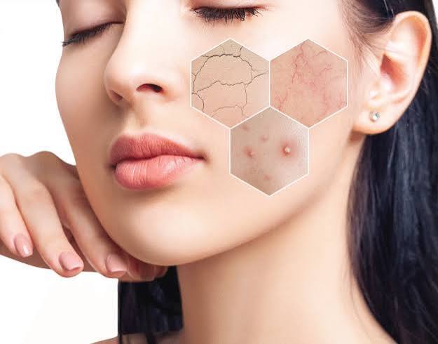 Dry Skin & Psoriasis
